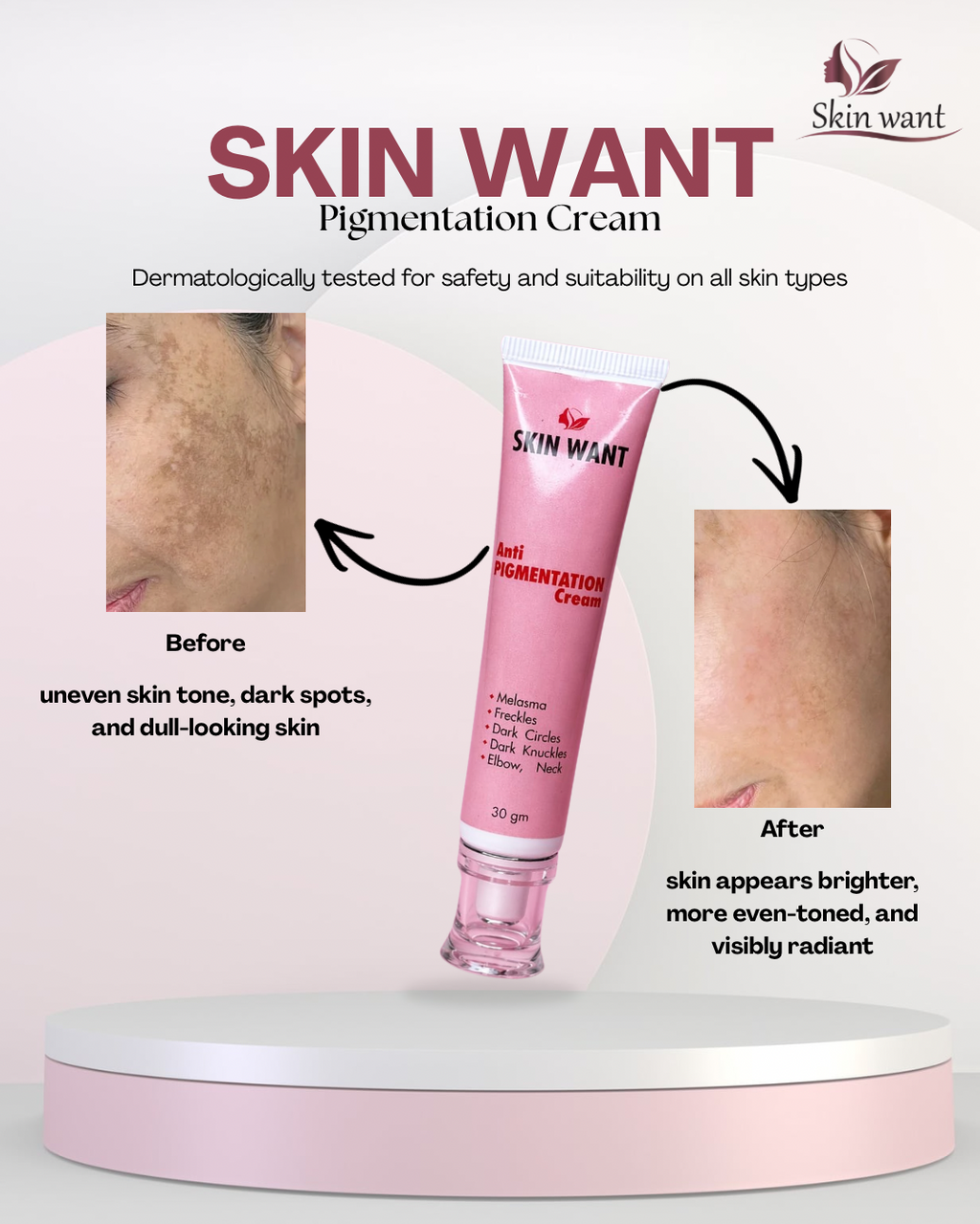 SKIN WANT PIGMENTATIEON CREAM