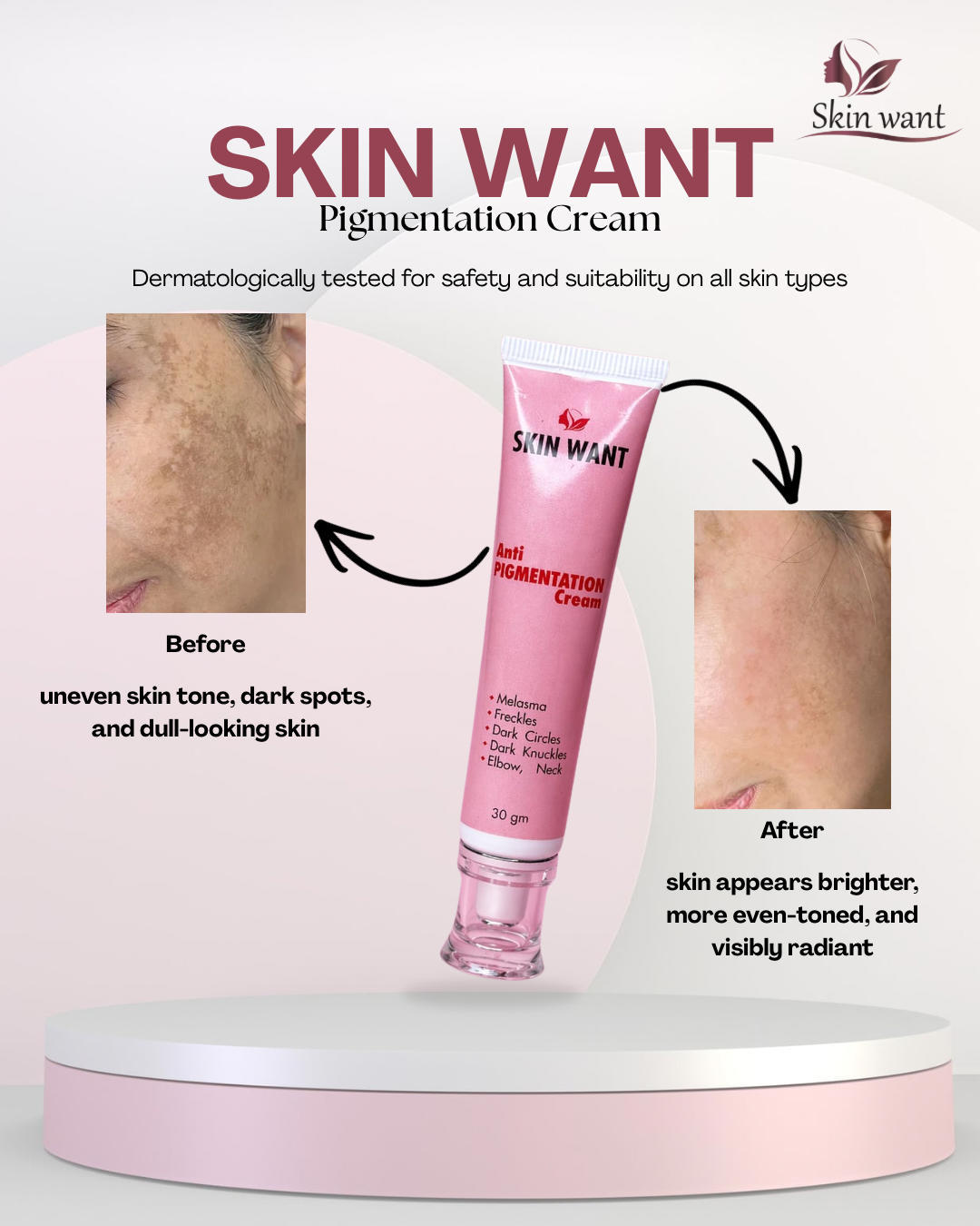 SKIN WANT PIGMENTATIEON CREAM